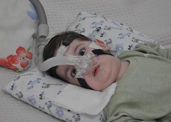 35 milyon lira toplandı! SMA’lı Yunus bebek Almanya’ya gidecek