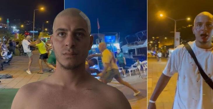 Alanya’da 6 kişinin deviremediği gurbetçi boksör dehşeti anlattı: Vücudumda demir eğdiler