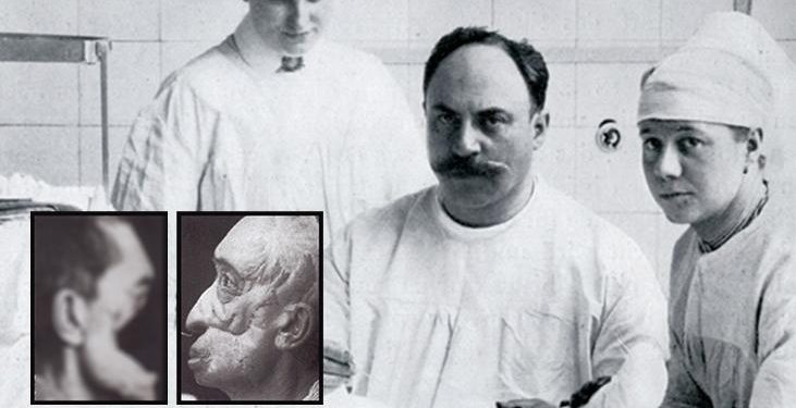 Türk asker yüzünü Çanakkale’de kaybetti! ‘Buruncu Joseph’ mucizeler yarattı